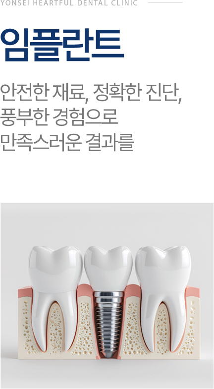 임플란트