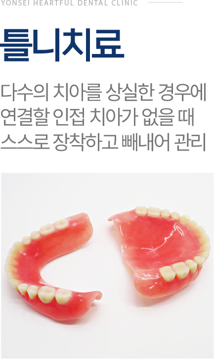 틀니치료