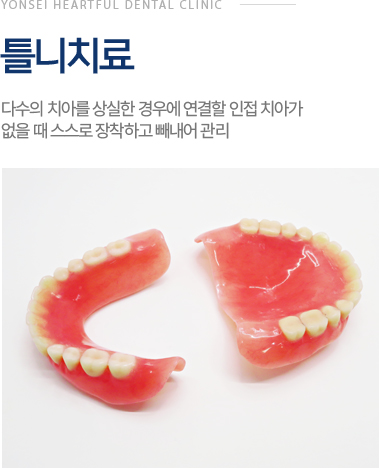 틀니치료